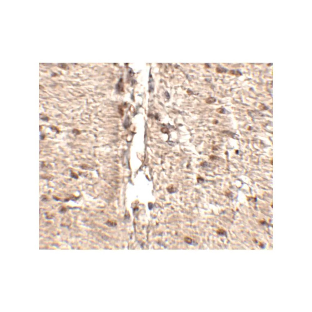 ProSci 4835 Rkhd1 Antibody