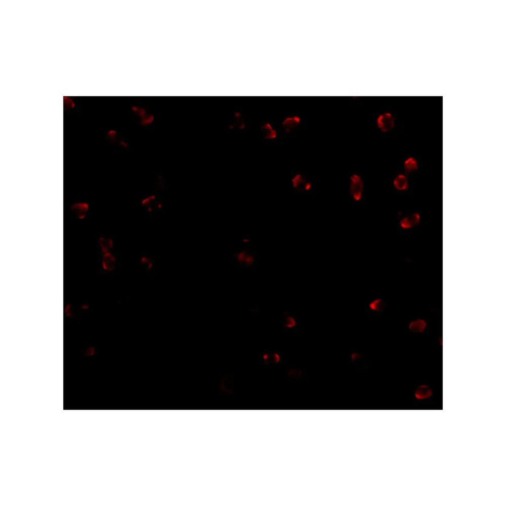 ProSci 4837 Integrin alpha 4 Antibody