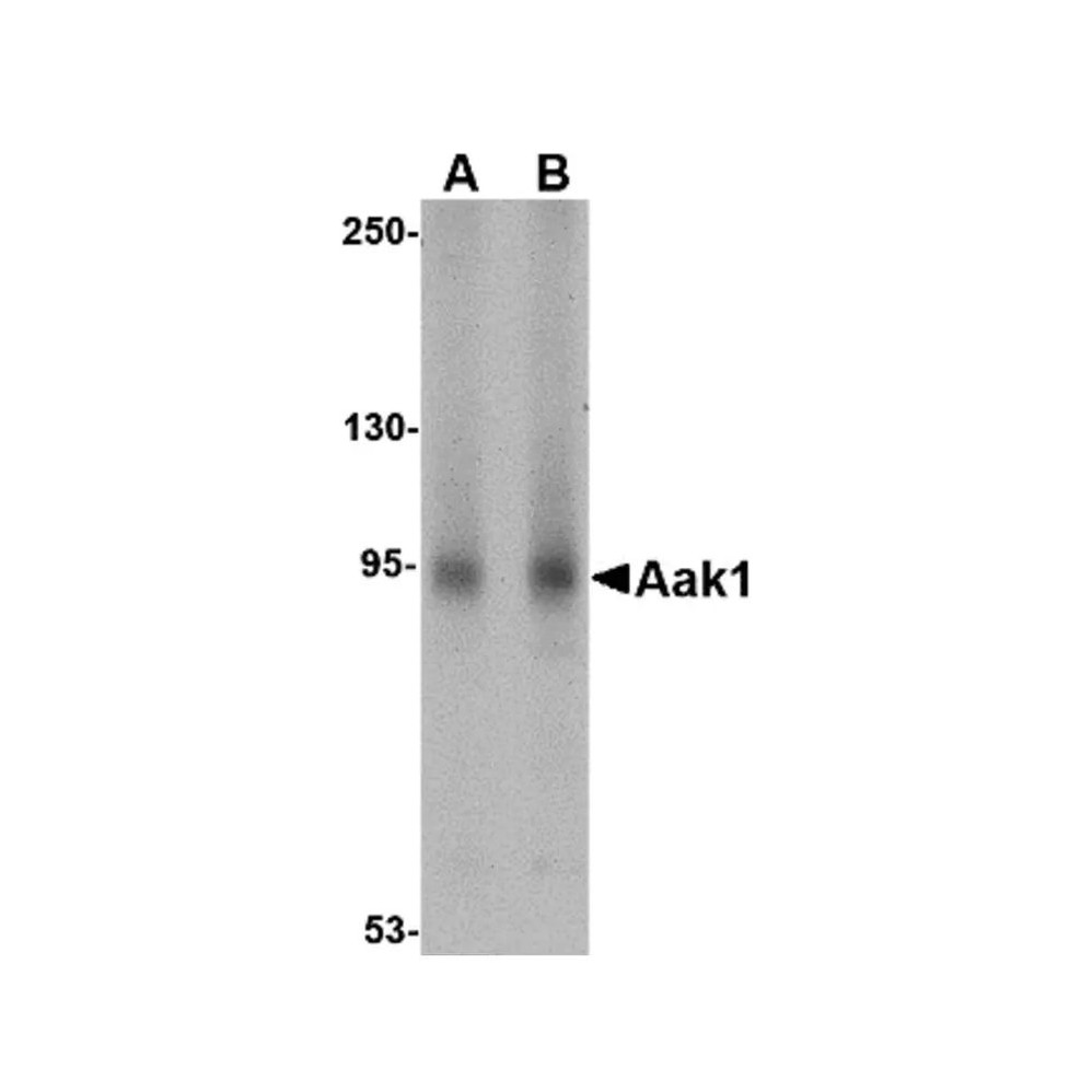 ProSci 4841 Aak1 Antibody