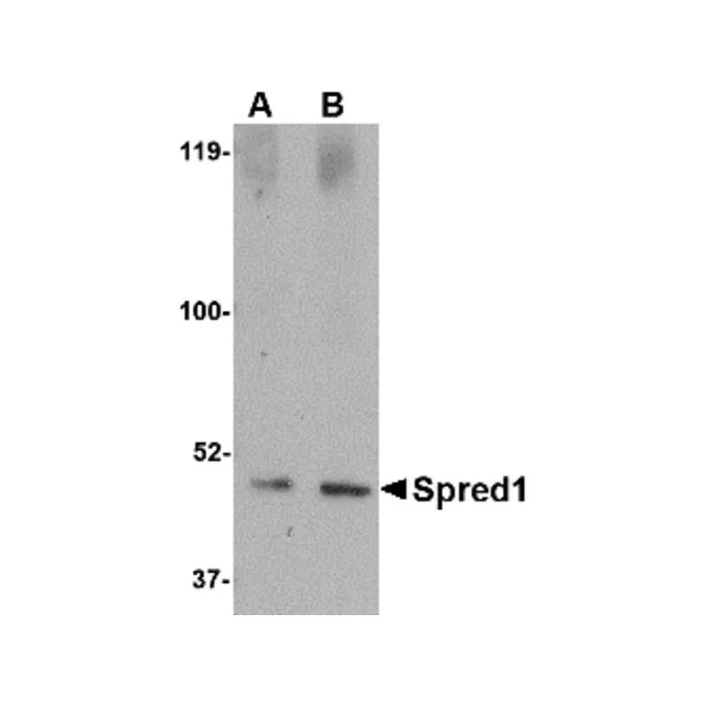 ProSci 4843 Spred1 Antibody