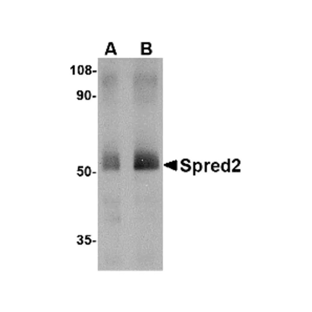 ProSci 4849 Spred2 Antibody