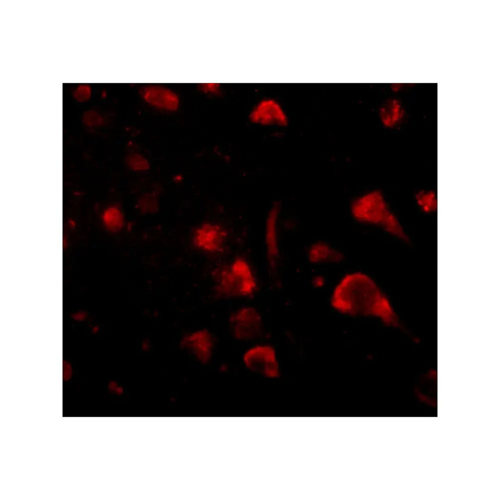 ProSci 4851 Spred3 Antibody