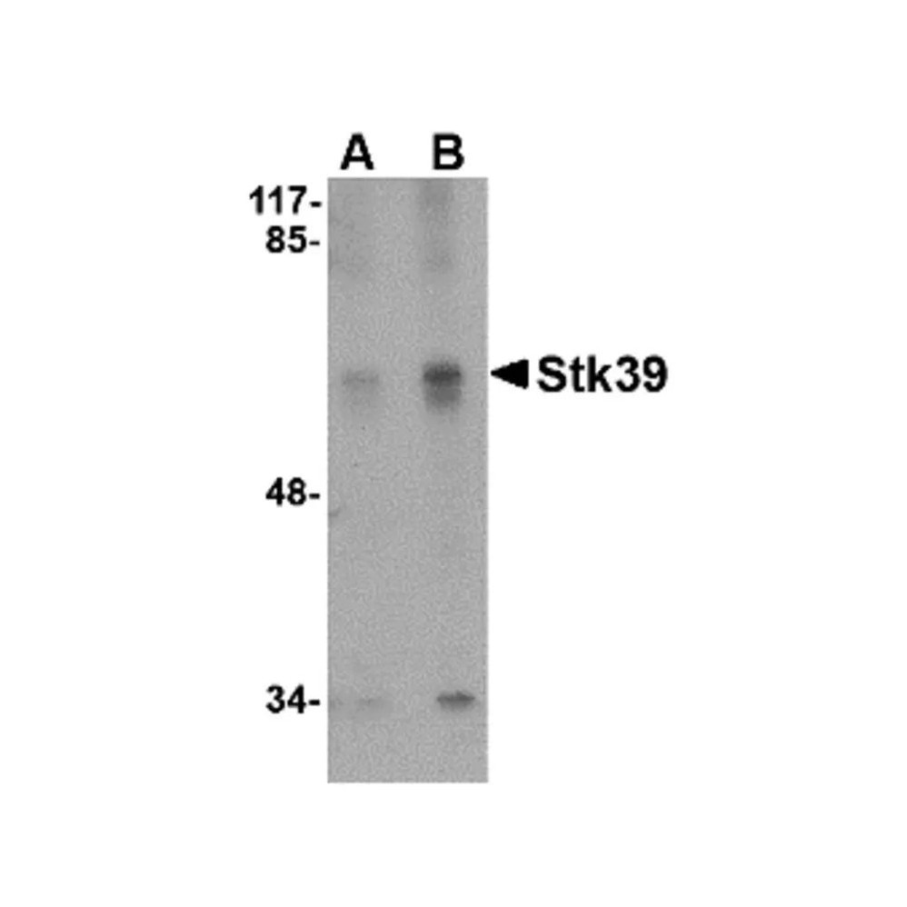 ProSci 4855 Stk39 Antibody