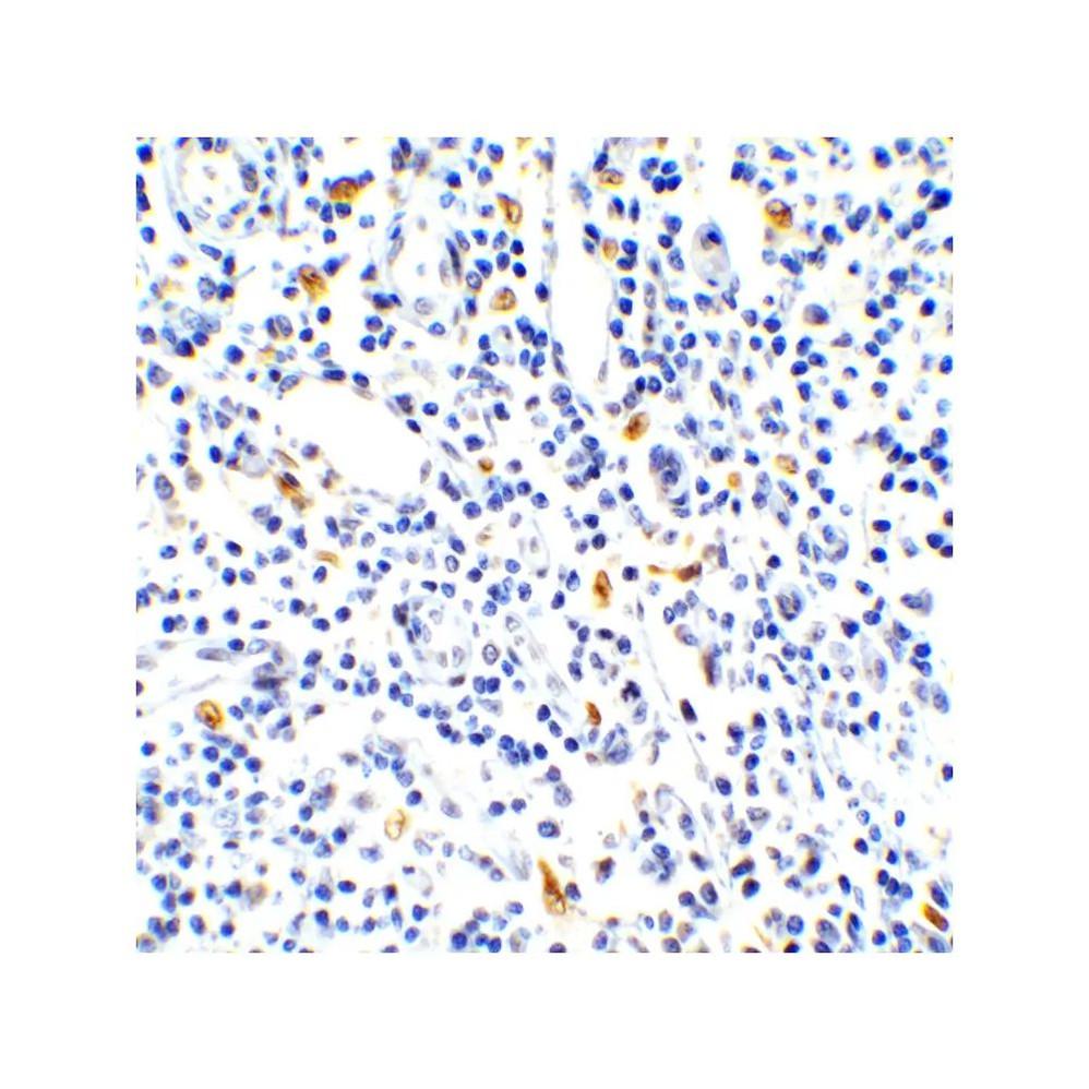 ProSci 4887 IL-17 Antibody