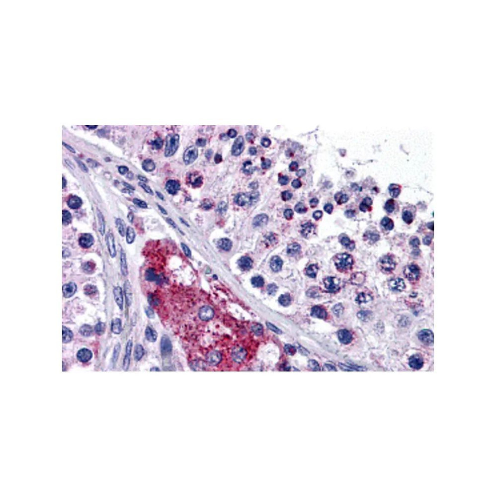 ProSci 4915 PTCHD2 Antibody