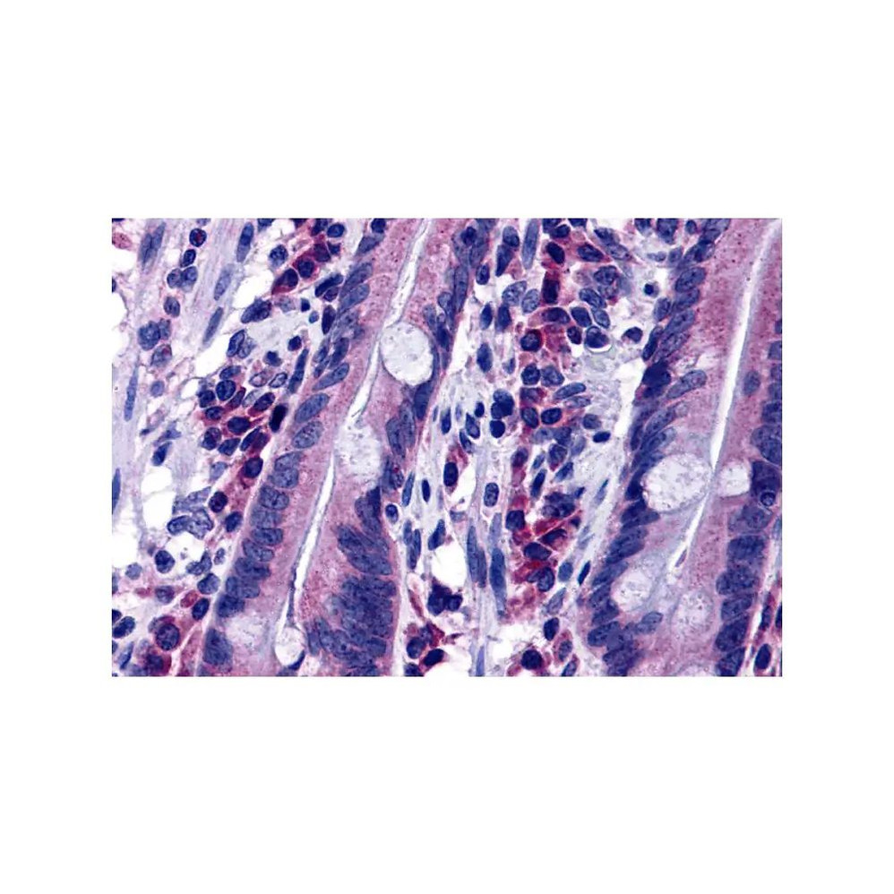 ProSci 4893 DISP2 Antibody