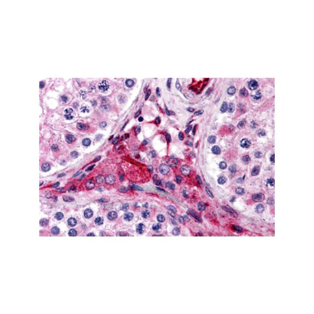 ProSci 4925 PTCHD2 Antibody