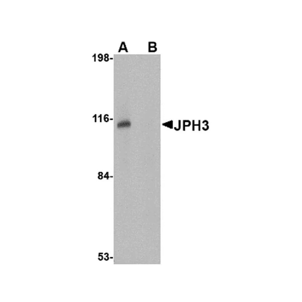 ProSci 4931 JPH3 Antibody