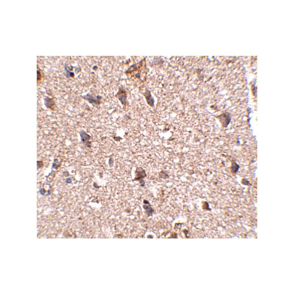 ProSci 4931 JPH3 Antibody