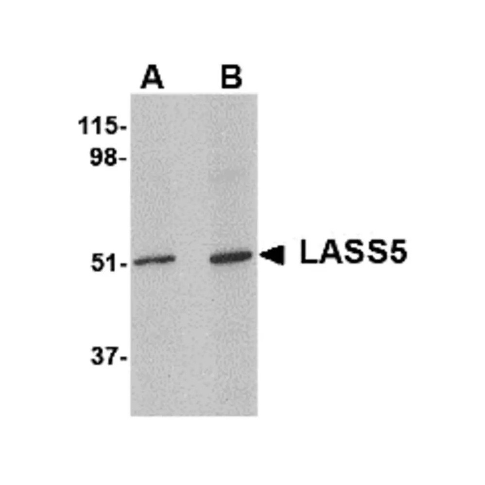 ProSci 4939 LASS5 Antibody