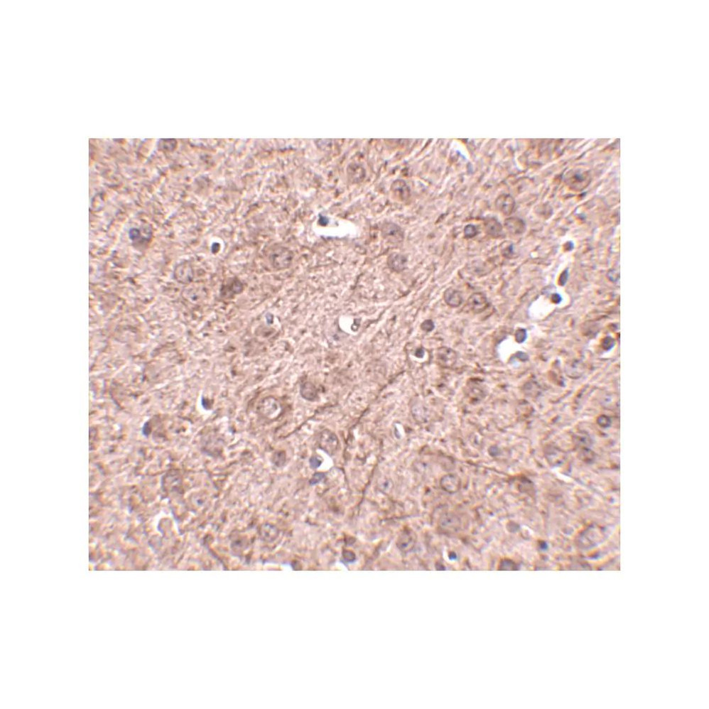 ProSci 4941 LASS6 Antibody