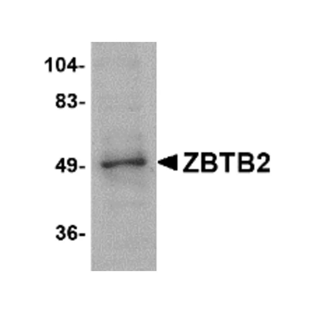 ProSci 4961 ZBTB2 Antibody