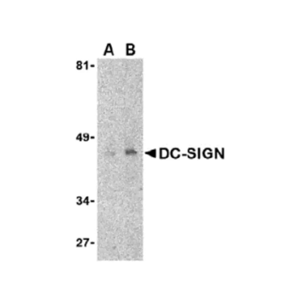 ProSci PM-2348 DC-SIGN Antibody