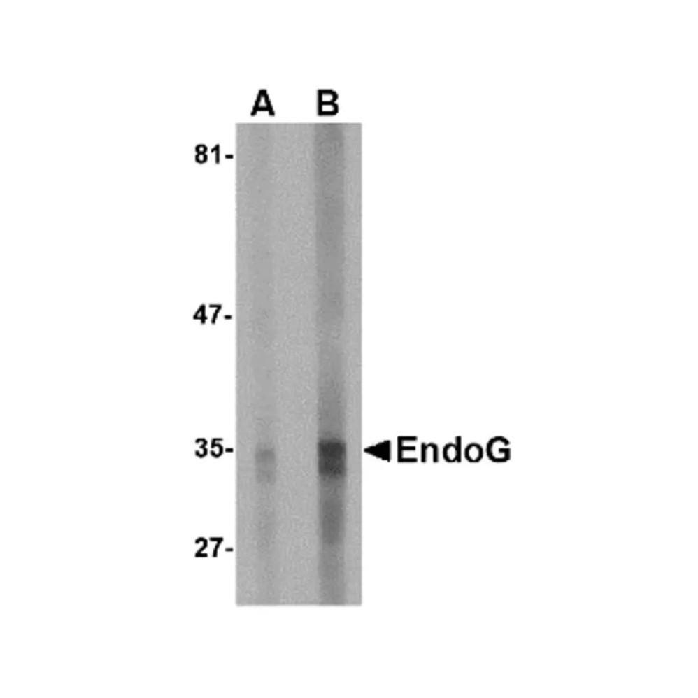 ProSci PM-4579 EndoG Antibody