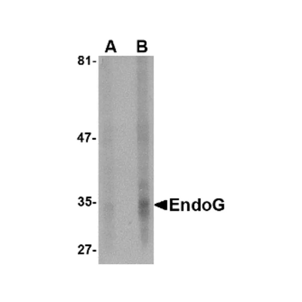 ProSci PM-4583 EndoG Antibody