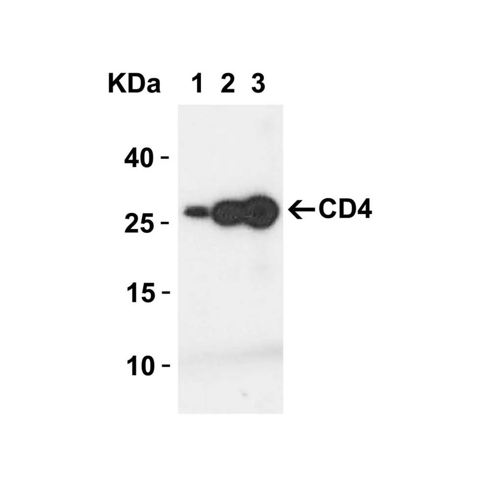 ProSci PM-5201 CD4 Antibody
