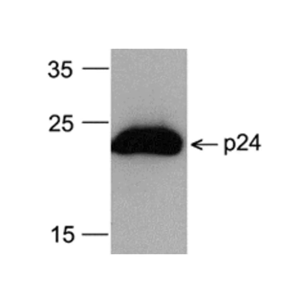 ProSci PM-6335-HRP HIV-1 p24 Antibody