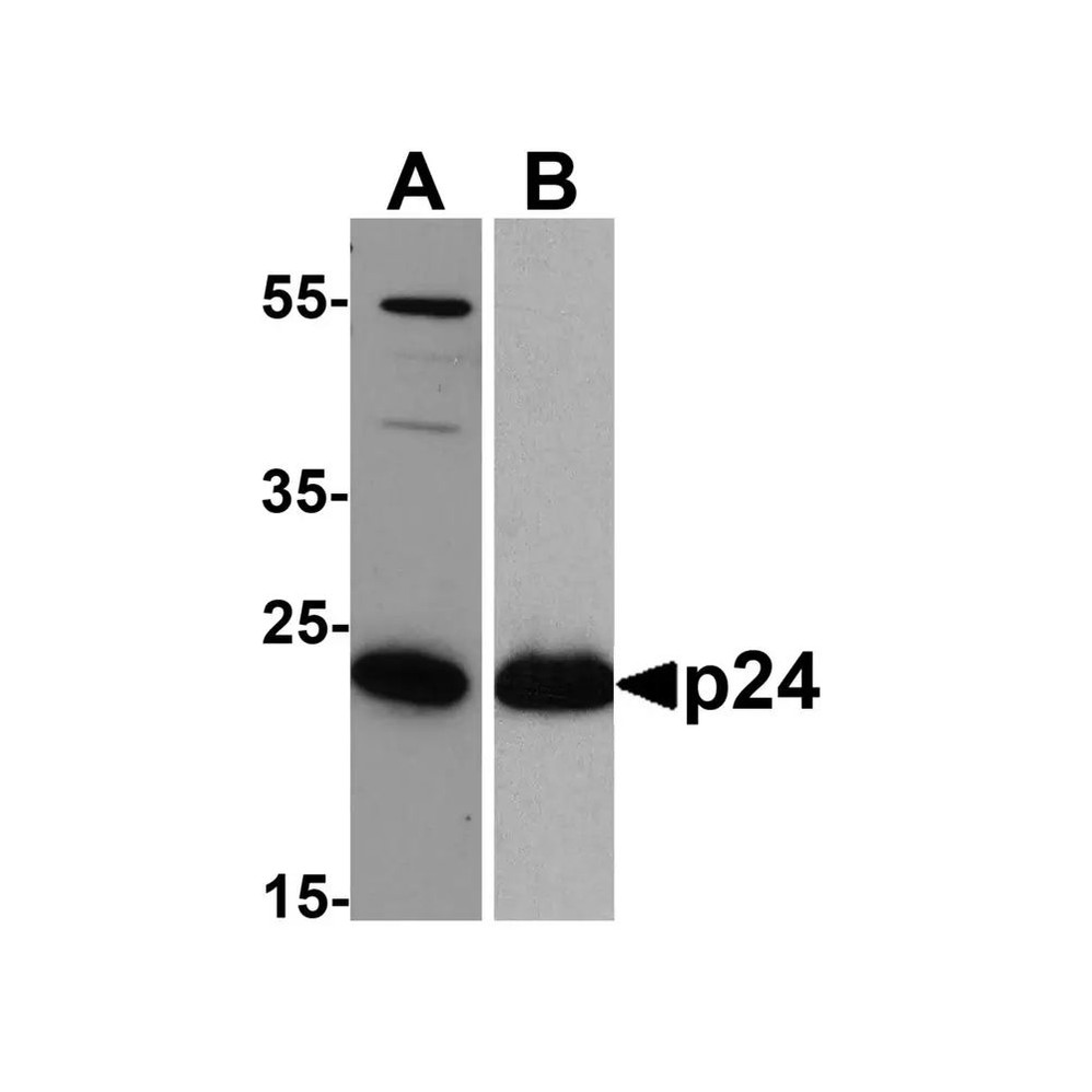 ProSci PM-6585 HIV-1 p24 Antibody
