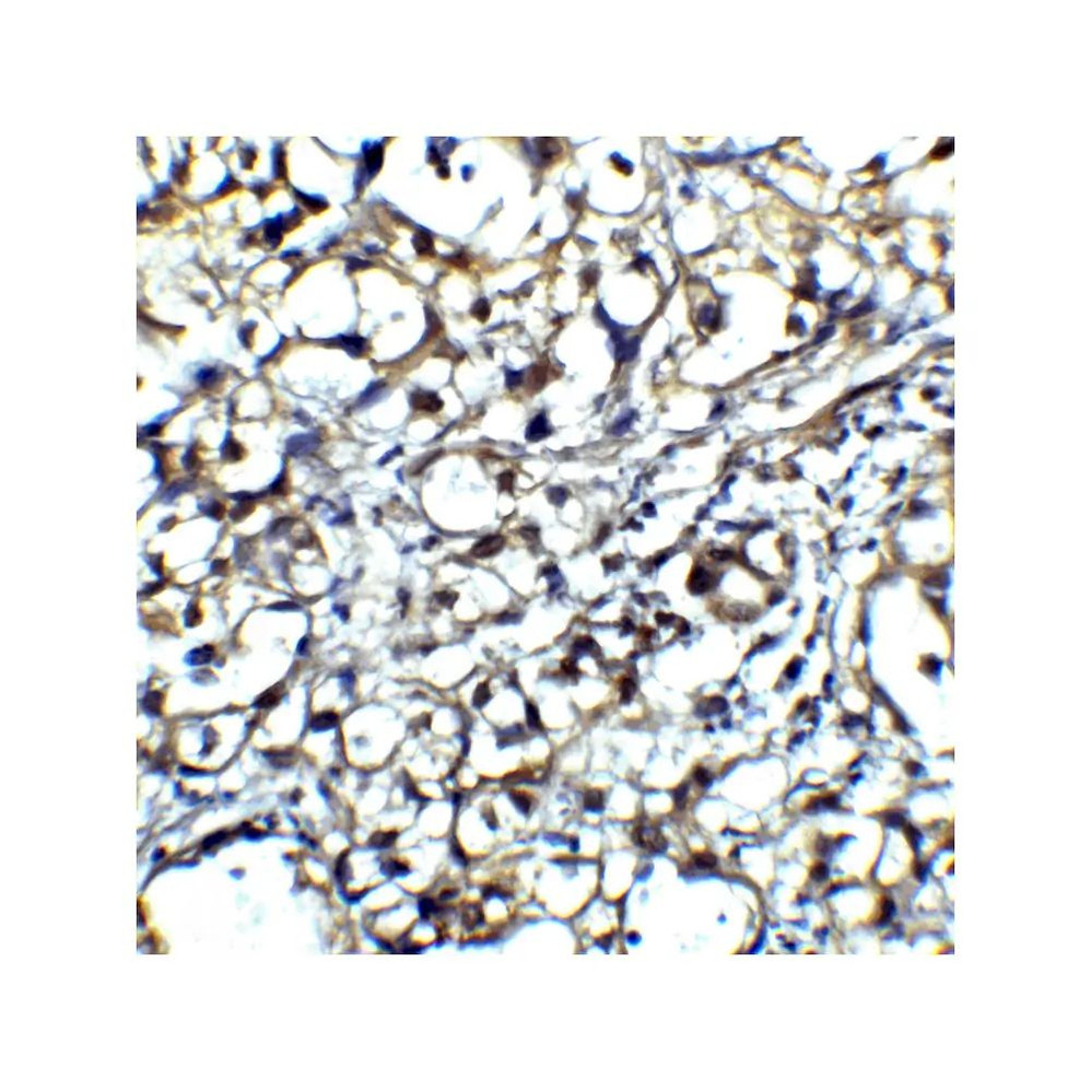 ProSci RF16013 CTLA4 Antibody