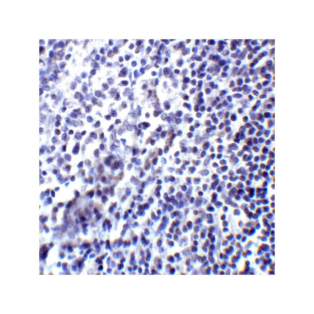 ProSci RF16025 PDL2 Antibody