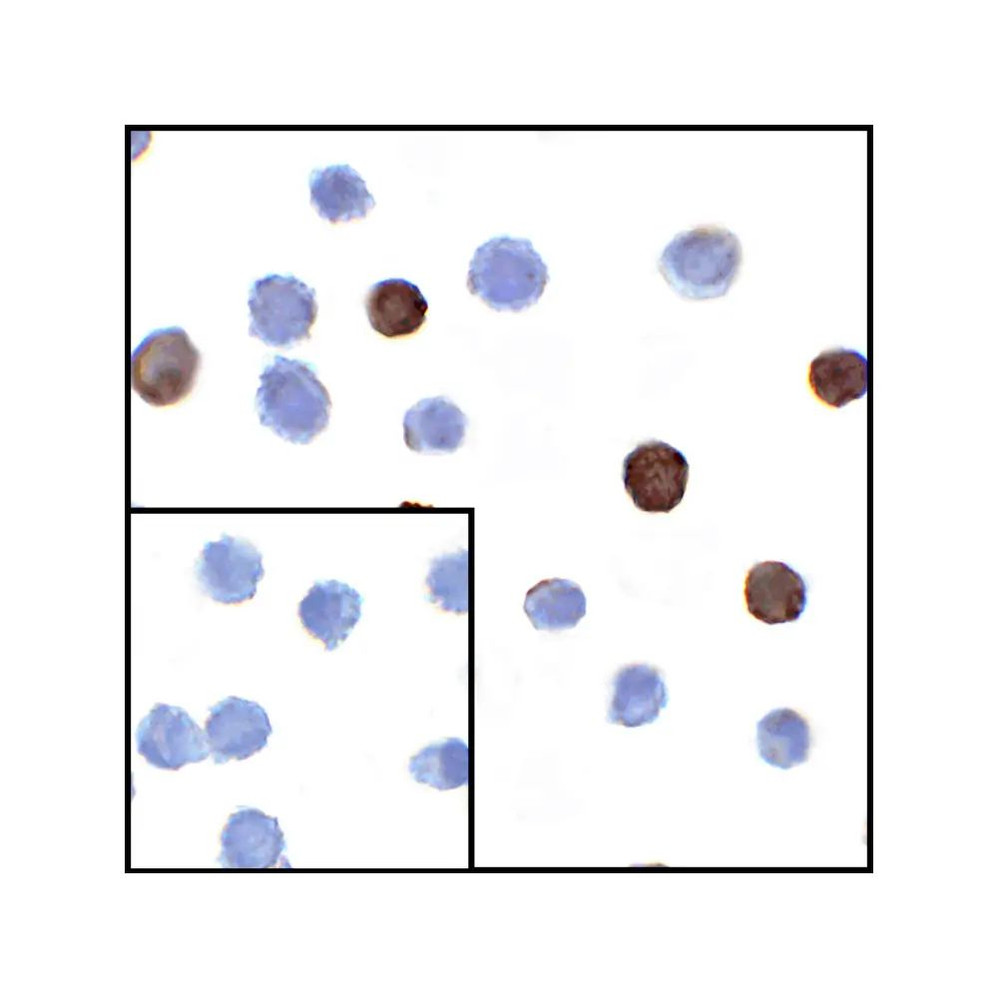 ProSci RF16064 LIGHT Antibody