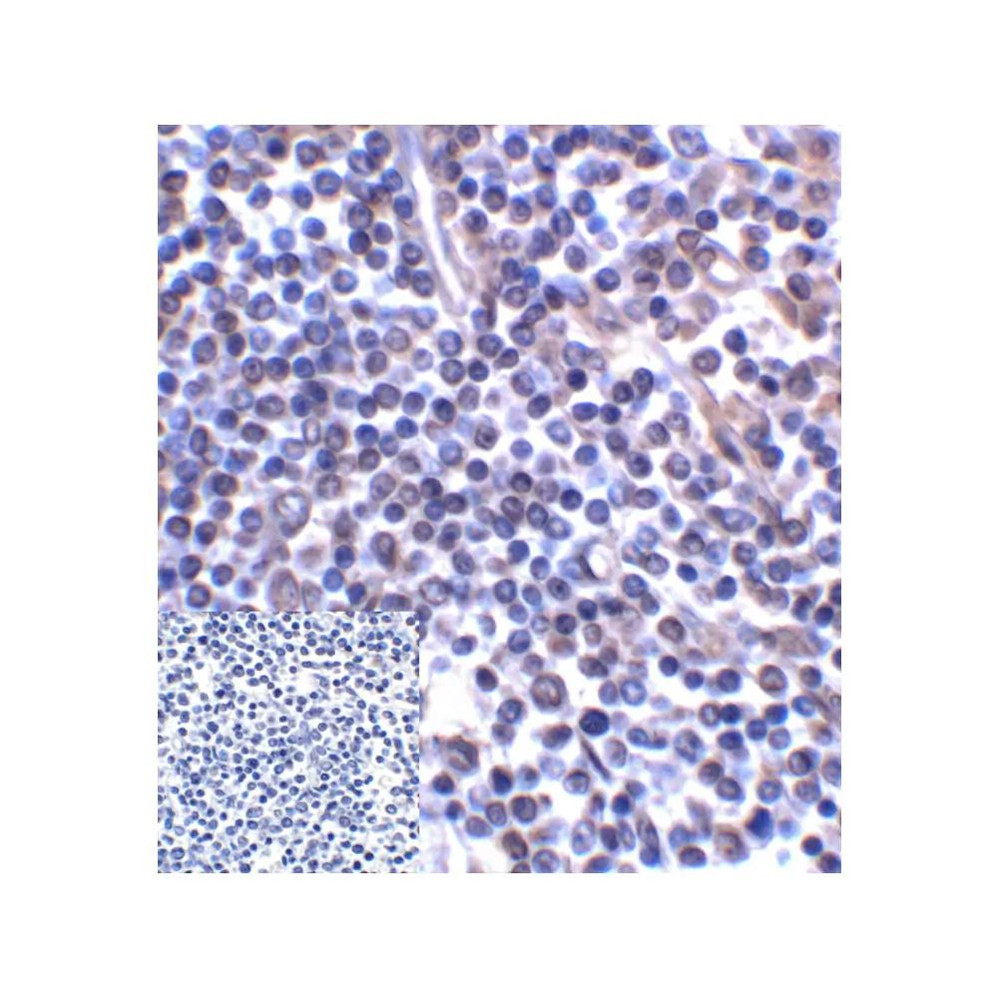 ProSci RF16095 B7H3 Antibody