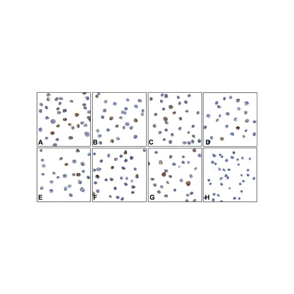 (GS1-7084) LAG3 Detection Set (Risk Free) ProSci 1 Set/Unit