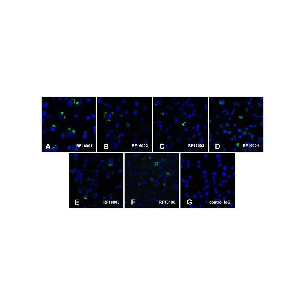 (GS1-6987) PD1 Detection Set (Risk Free) ProSci 1 Set/Unit