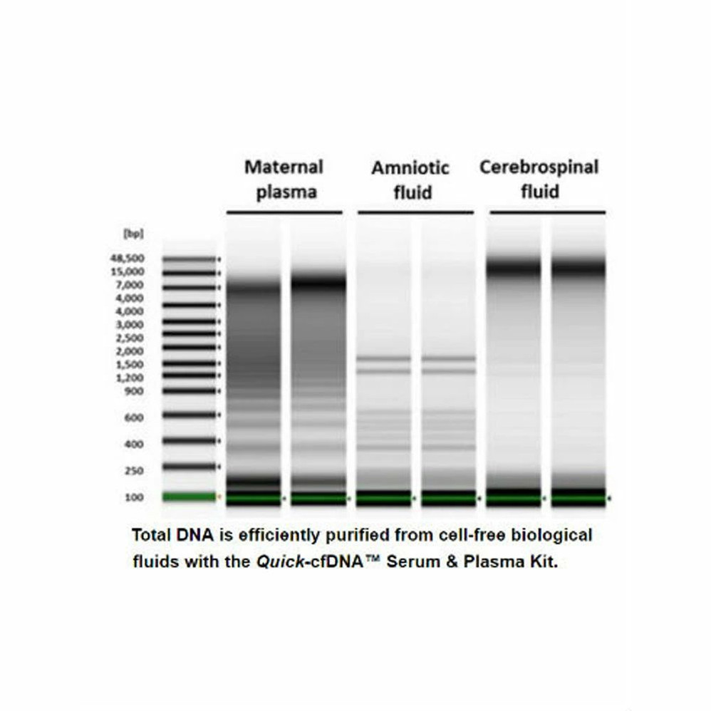 (11-363) Quick-cfDNA Serum & Plasma Kit Zymo Research 50 Preps/Unit