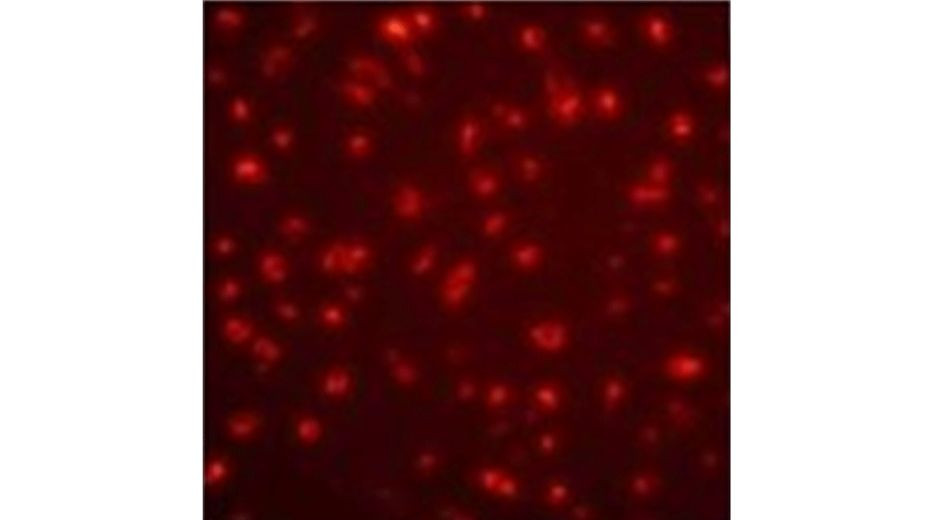 title: Delivery of Pep-A (Streptococcus TPE B epitope, 16 aa), into HeLa cells.; description: Complexes are formed with Pep-A (1 µg, lissamine-rhodamine derivative, Sigma) and PULSin® (4 µl). Observation is carried out 16 h post-delivery.