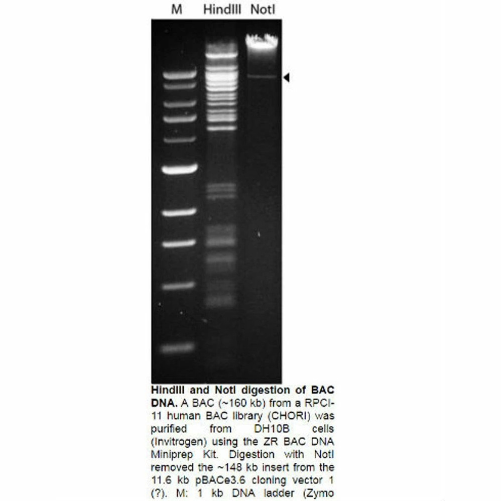 ZR BAC DNA Miniprep Kits