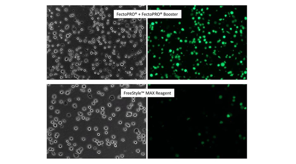 FectoPRO® DNA Transfection Reagent