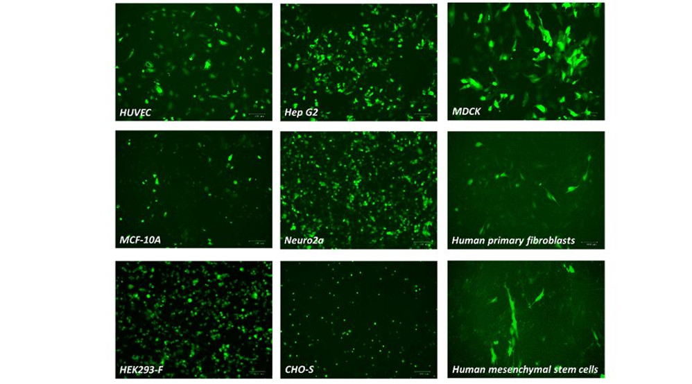 jetOPTIMUS® DNA Transfection Reagent