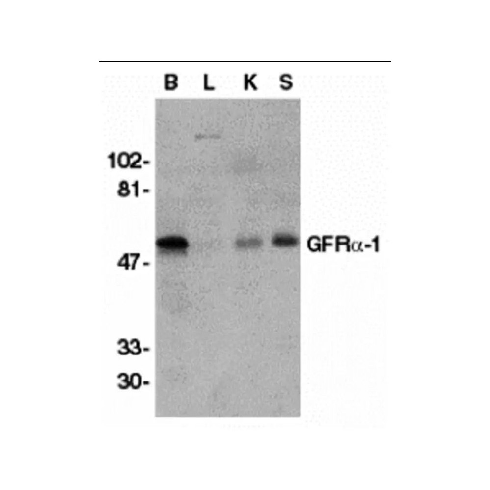 ProSci 1133 GFR alpha 1 Antibody