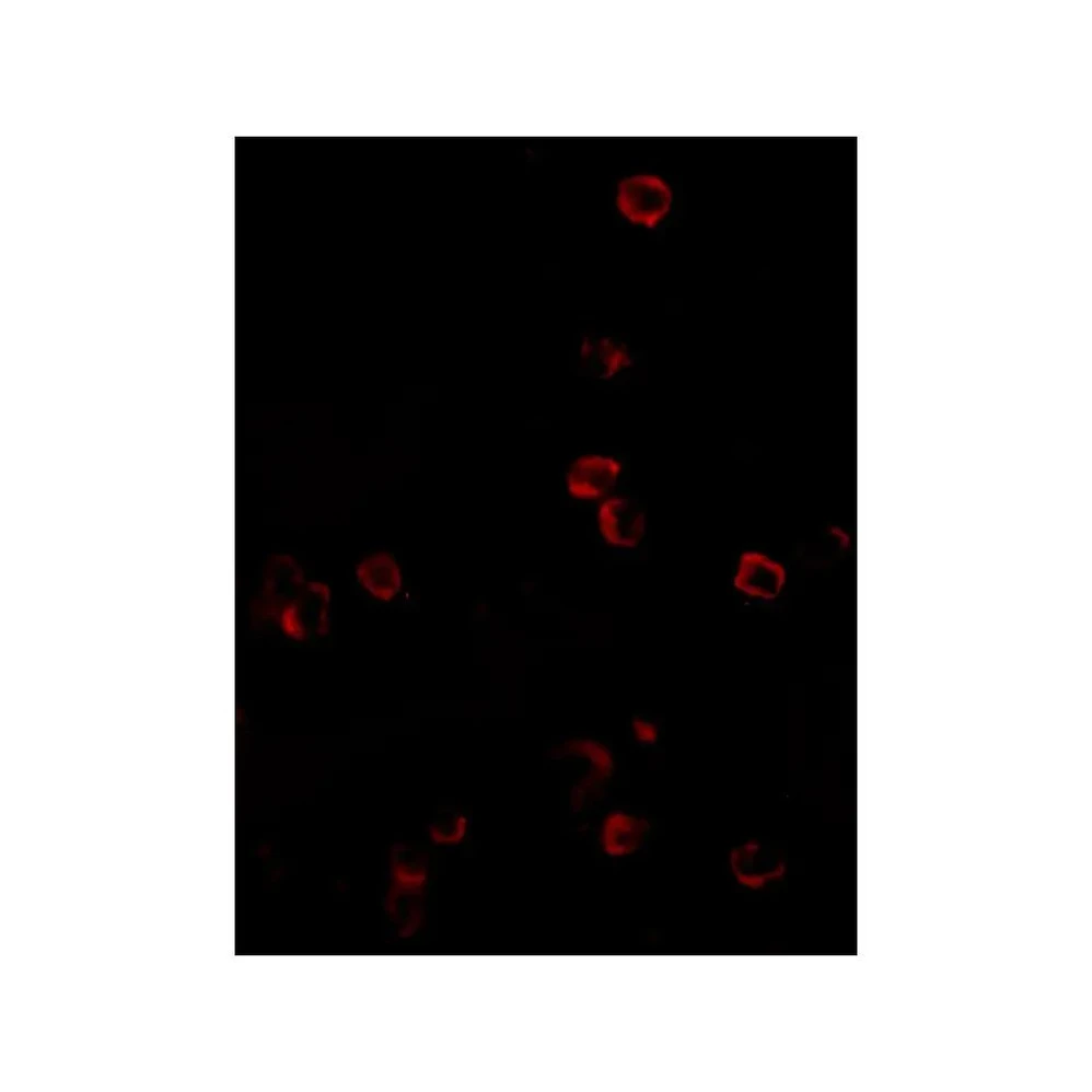 ProSci 4999 KLRA1 Antibody