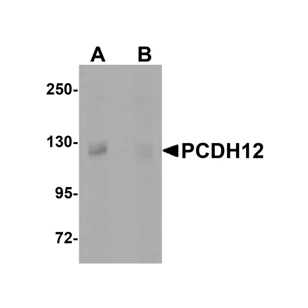 ProSci 5071 PCDH12 Antibody
