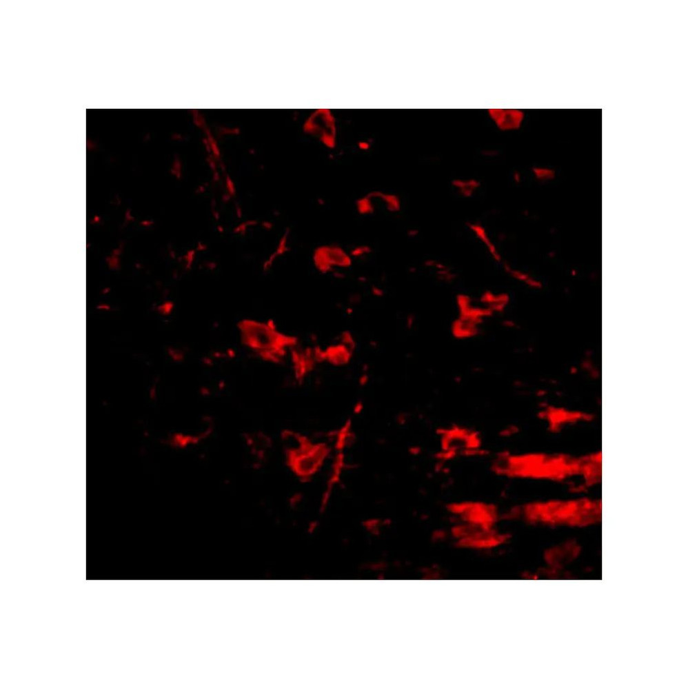 ProSci 5051 RCAN2 Antibody