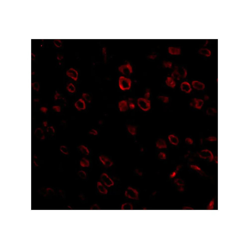 ProSci 5135 FKBP15 Antibody
