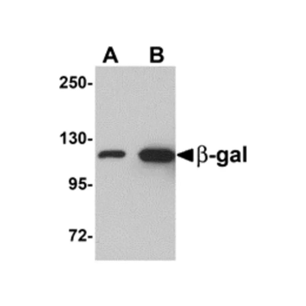 ProSci 5155 beta-Galactosidase Antibody