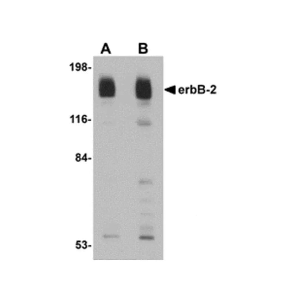 ProSci 5153 erbB-2 Antibody