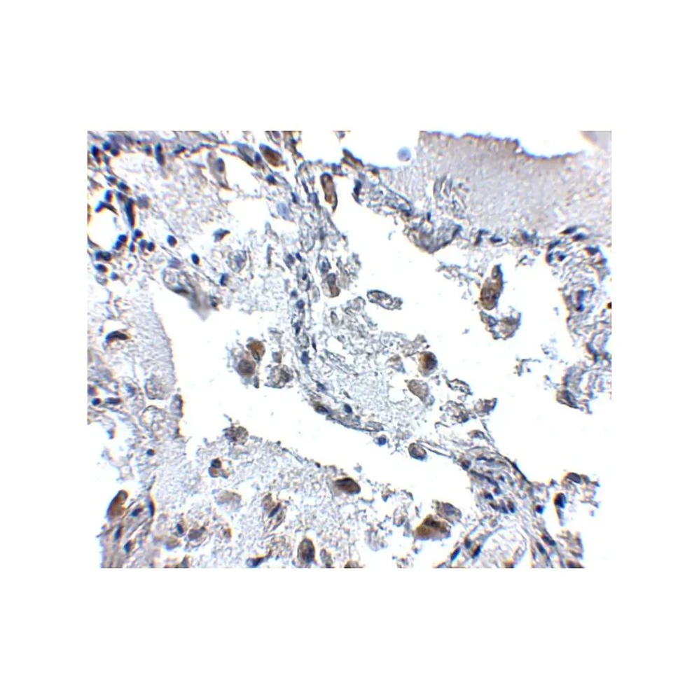 ProSci 5167 SH3BP4 Antibody