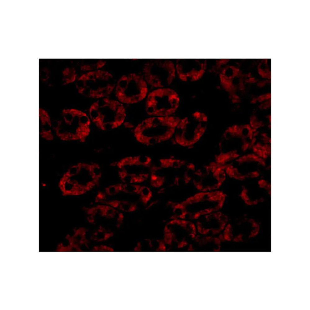 ProSci 5185 NPC1 Antibody