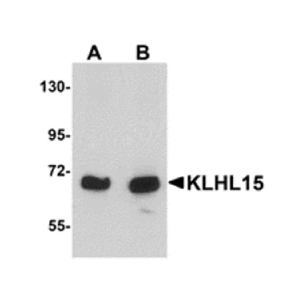 ProSci 5223 KLHL15 Antibody