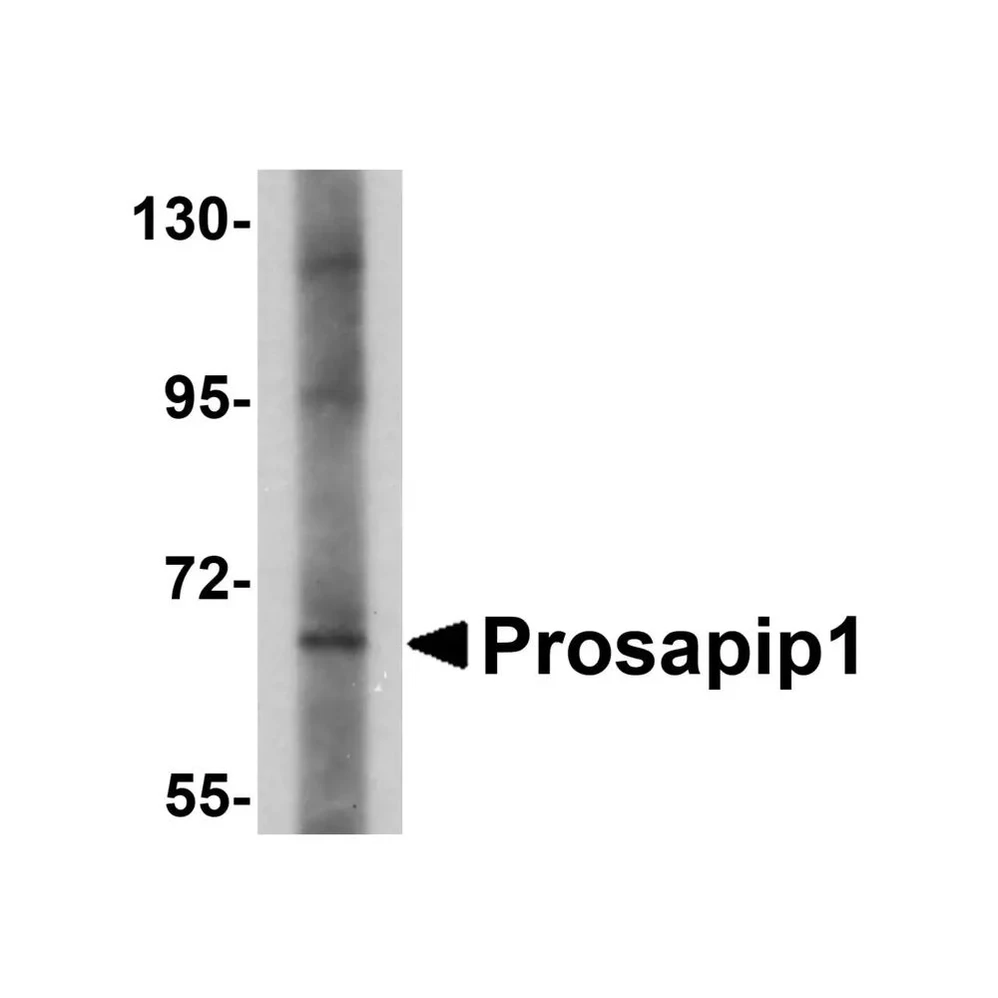 ProSci 5395 Prosapip1 Antibody