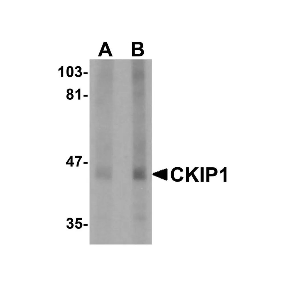 ProSci 5435 CKIP1 Antibody