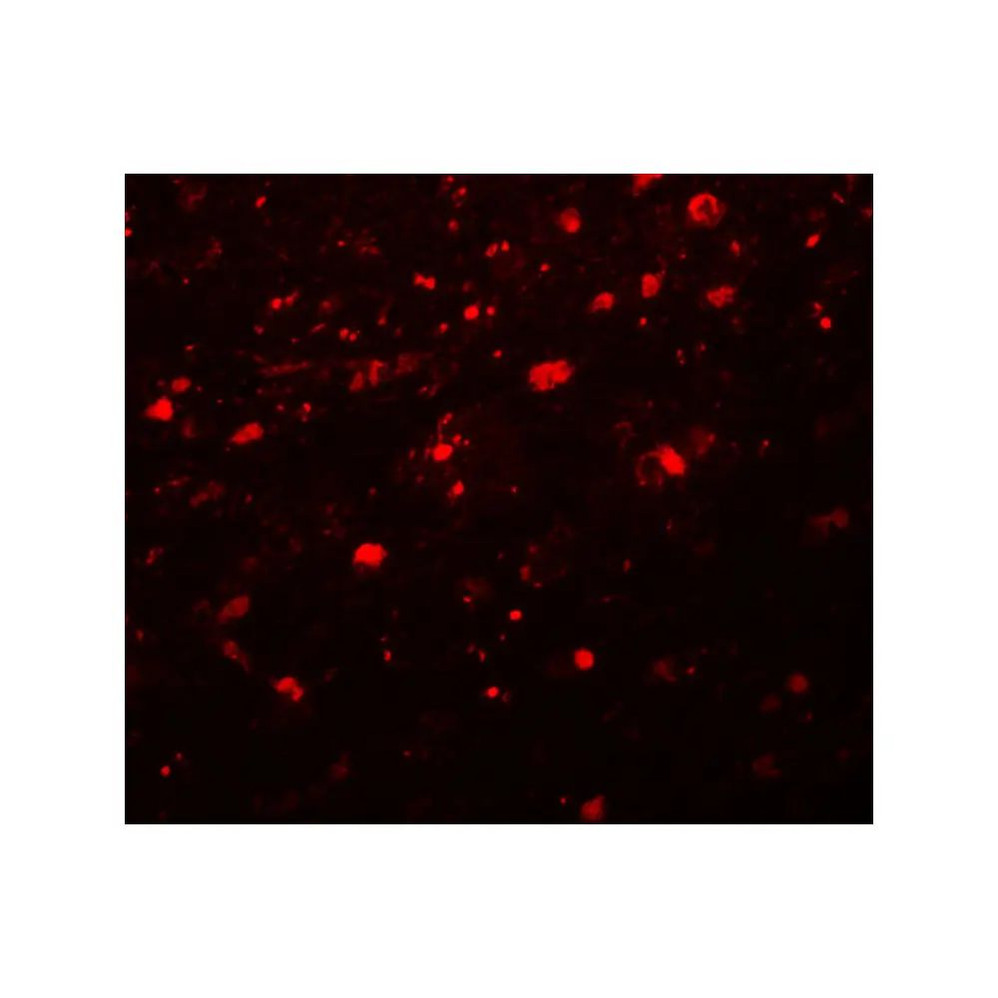 ProSci 5545 Girdin Antibody