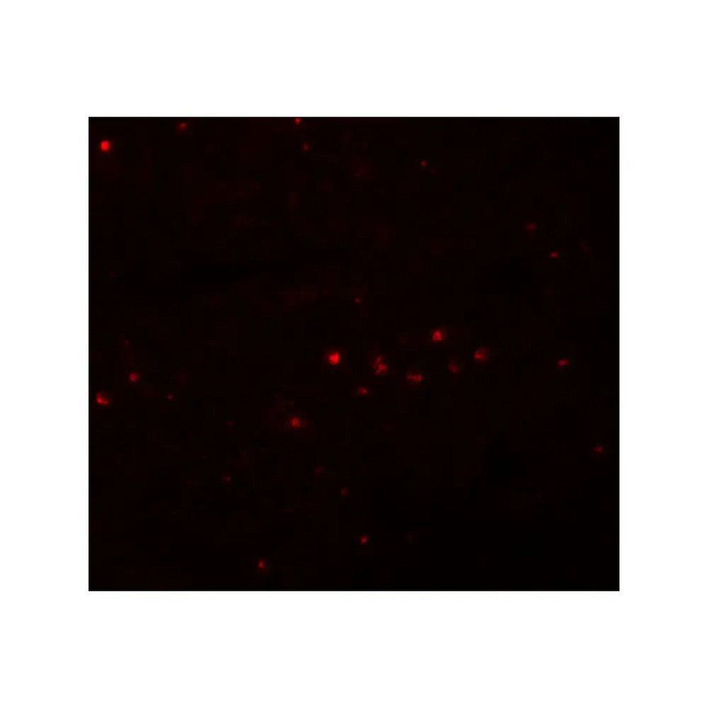 ProSci 5655 EFHD1 Antibody