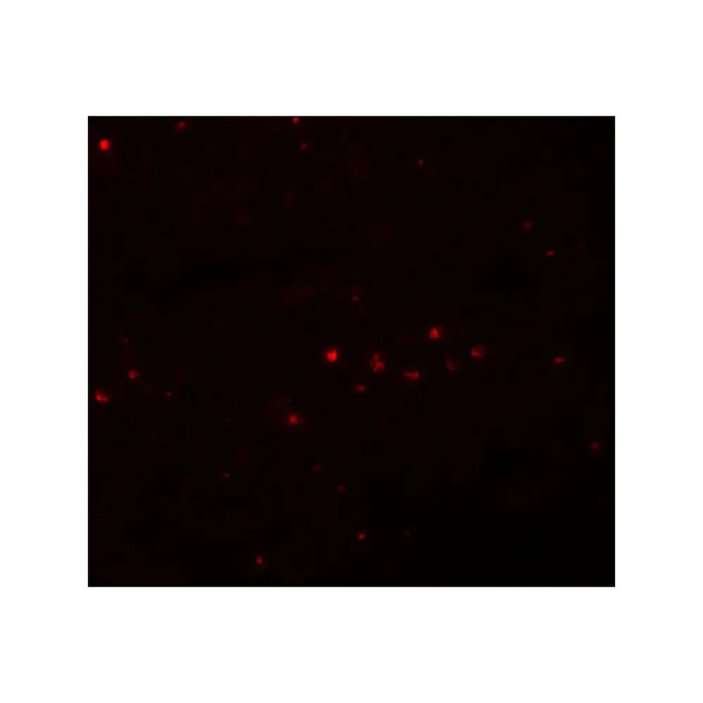 ProSci 5655 EFHD1 Antibody