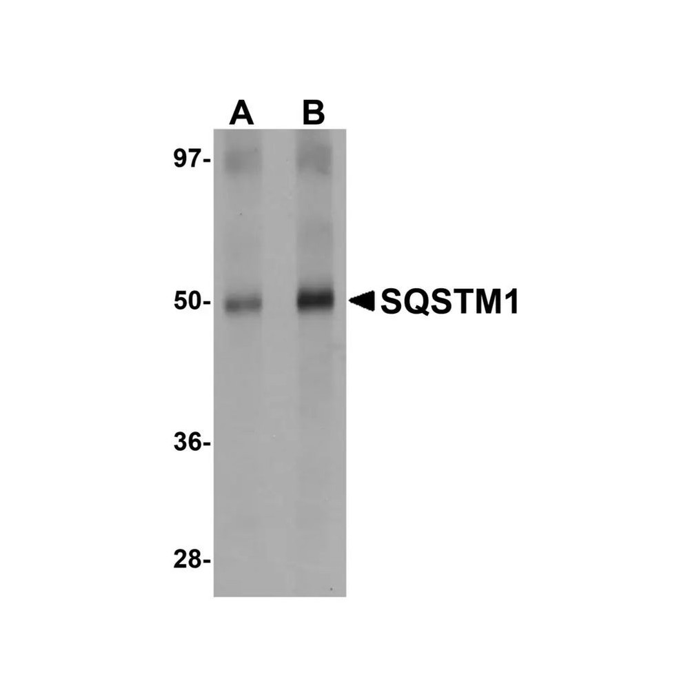 ProSci 5449 SQSTM1 Antibody