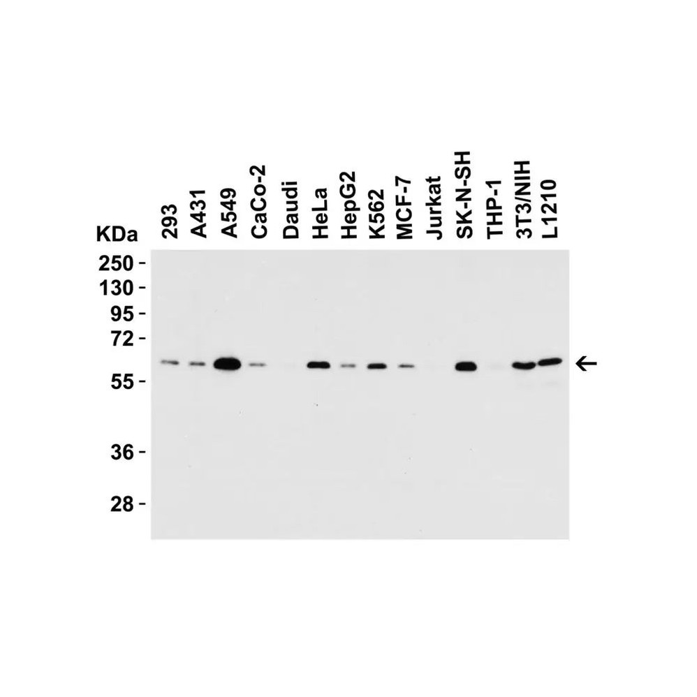 ProSci 5449 SQSTM1 Antibody